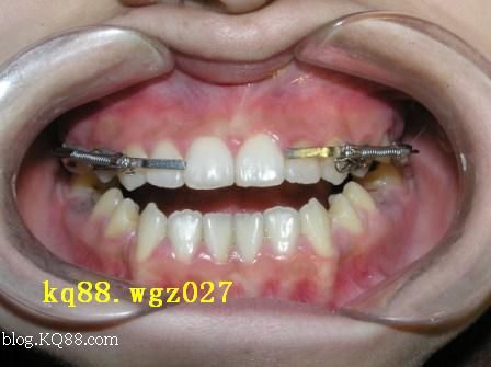 “BJL平台集团”人民日报海外版:解决拖欠中小企业账款支付有了制度保障(图1) BJL平台